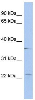 WB Suggested Anti-LYSMD2 Antibody Titration: 0.2-1 ug/ml; ELISA Titer: 1:312500; Positive Control: HepG2 cell lysate