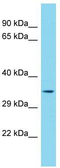 Host: Rabbit; Target Name: MEDAG; Sample Tissue: HepG2 Whole Cell lysates; Antibody Dilution: 1.0 ug/ml.