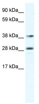WB Suggested Anti-MEF2B Antibody Titration: 0.625 ug/ml; ELISA Titer: 1:312500; Positive Control: Human Lymphnode