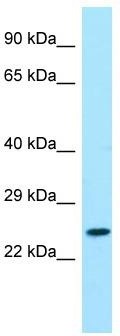 Host: Rabbit; Target Name: MSGN1; Sample Tissue: HepG2 Whole Cell lysates; Antibody Dilution: 1.0 ug/ml