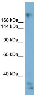 WB Suggested Anti-EXPH5 Antibody Titration: 0.2-1 ug/ml; ELISA Titer: 1: 312500; Positive Control: ACHN cell lysate