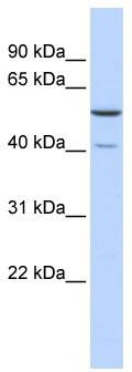 WB Suggested Anti-METT5D1 Antibody Titration: 0.2-1 ug/ml; ELISA Titer: 1:1562500; Positive Control: Human brain