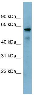 WB Suggested Anti-METTL14  Antibody Titration: 0.2-1 ug/ml; ELISA Titer: 1: 1562500; Positive Control: NCI-H226 cell lysate