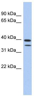 WB Suggested Anti-TRMT44 Antibody Titration: 0.2-1 ug/ml; ELISA Titer: 1: 312500; Positive Control: Human Spleen