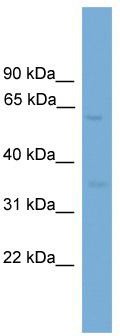 WB Suggested Anti-MFSD8 Antibody Titration: 0.2-1 ug/ml; ELISA Titer: 1:312500; Positive Control: HepG2 cell lysate