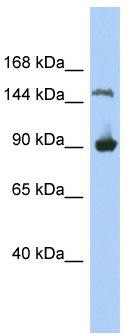 WB Suggested Anti-MGC50722 Antibody Titration: 0.2-1 ug/ml; ELISA Titer: 1:312500; Positive Control: 293T cell lysate