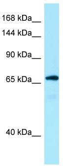 WB Suggested Anti-MON2 Antibody; Titration: 1.0 ug/ml; Positive Control: Fetal Kidney