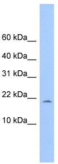 WB Suggested Anti-MORN4 Antibody Titration: 0.2-1 ug/ml; Positive Control: 721_B cell lysate