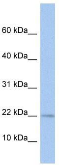 WB Suggested Anti-MPV17L Antibody Titration: 0.2-1 ug/ml; ELISA Titer: 1:312500; Positive Control: THP-1 cell lysate