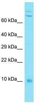 Host: Rabbit; Target Name: C7orf49; Sample Tissue: MDA-MB-435S Whole Cell lysates; Antibody Dilution: 1.0ug/mlC7orf49 is supported by BioGPS gene expression data to be expressed in MDA-MB435
