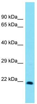 Host: Rabbit; Target Name: Msx3; Sample Tissue: Rat Lung lysates; Antibody Dilution: 1.0 ug/ml