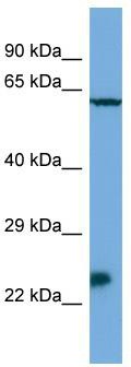 Host: Rabbit; Target Name: Msx3; Sample Tissue: SP2/0 Whole Cell lysates; Antibody Dilution: 1.0 ug/ml