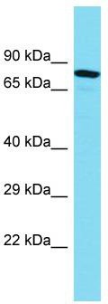 Host: Rabbit; Target Name: MTMR10; Sample Tissue: ACHN whole cell lysates; Antibody Dilution: 1.0ug/ml