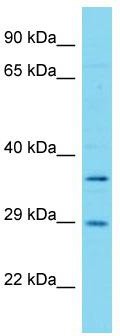 Host: Rabbit; Target Name: FAHD1; Sample Tissue: Hela Whole cell lysates; Antibody Dilution: 1.0ug/ml