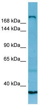 WB Suggested Anti-MYH13 Antibody; Titration: 1.0 ug/ml; Positive Control: Fetal Lung