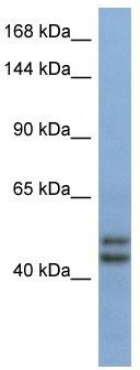 Host: Rabbit; Target Name: TEX10; Sample Tissue: Fetal Brain lysates; Antibody Dilution: 1.0 ug/ml