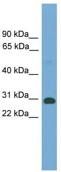 WB Suggested Anti-Tgifx1 Antibody Titration: 0.2-1 ug/ml; Positive Control: Mouse Muscle