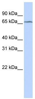 WB Suggested Anti-TRMT5 Antibody Titration: 0.2-1 ug/ml; ELISA Titer: 1:62500; Positive Control: MCF7 cell lysateTRMT5 is supported by BioGPS gene expression data to be expressed in MCF7