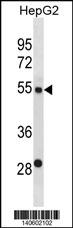 ST6GAL2 Antibody (C-term) (Cat# 102-14289) western blot analysis in HepG2 cell line lysates (35ug/lane).This demonstrates the ST6GAL2 antibody detected the ST6GAL2 protein (arrow).