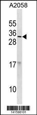 RNASE9 Antibody (C-term) (Cat# 102-14458) western blot analysis in A2058 cell line lysates (35ug/lane).This demonstrates the RNASE9 antibody detected the RNASE9 protein (arrow).
