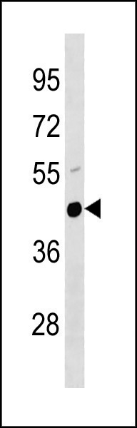 Mouse Plau Antibody (C-term) (Cat# 102-14636) western blot analysis in mouse lung tissue lysates (35ug/lane).This demonstrates the Mouse Plau antibody detected the Mouse Plau protein (arrow).