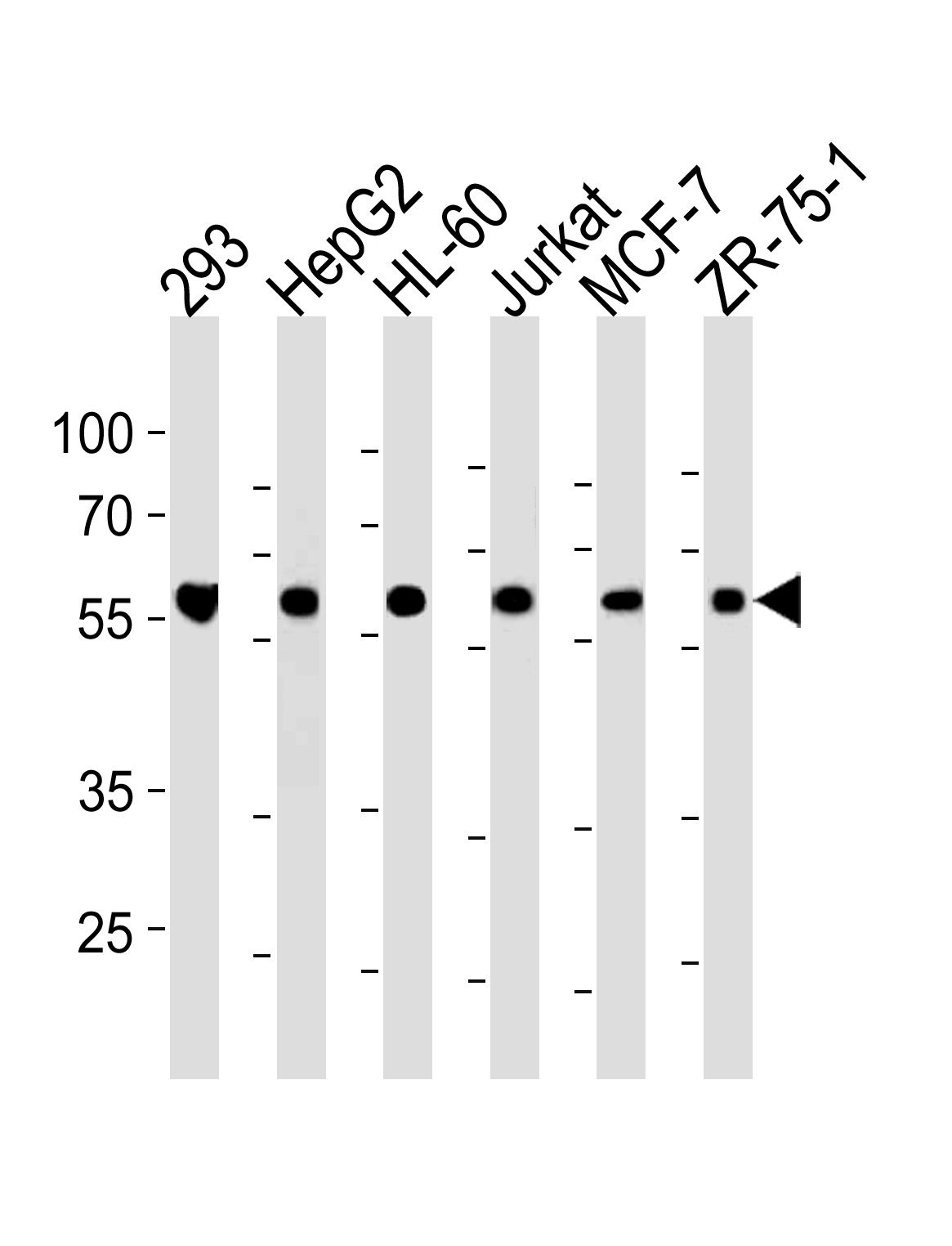 ZRSR2 Antibody (C-term) (Cat# 102-14778) western blot analysis in 293,HepG2,HL-60,Jurkat,MCF-7,ZR-75-1 cell line lysates (35ug/lane).This demonstrates the ZRSR2 antibody detected the ZRSR2 protein (arrow).