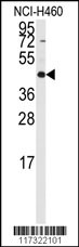 Western blot analysis of anti-RMND5B Antibody (C-term)(Cat# 102-15145) in NCI-H460 cell line lysates (35ug/lane). RMND5B(arrow) was detected using the purified Pab.