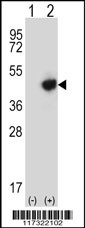 Western blot analysis of RMND5B (arrow) using rabbit polyclonal RMND5B Antibody (C-term) (Cat# 102-15145). 293 cell lysates (2 ug/lane) either nontransfected (Lane 1) or transiently transfected (Lane 2) with the RMND5B gene.