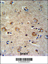 SETD6 Antibody (C-term) (Cat# 102-15773) IHC analysis in formalin fixed and paraffin embedded brain tissue followed by peroxidase conjugation of the secondary antibody and DAB staining. This data demonstrates the use of the SETD6 Antibody (C-term) for immunohistochemistry. Clinical relevance has not been evaluated.