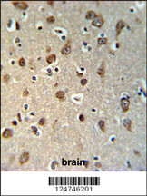 YMEL1 Antibody (N-term) (Cat# 102-15784) IHC analysis in formalin fixed and paraffin embedded brain tissue followed by peroxidase conjugation of the secondary antibody and DAB staining. This data demonstrates the use of the YMEL1 Antibody (N-term) for immunohistochemistry. Clinical relevance has not been evaluated.