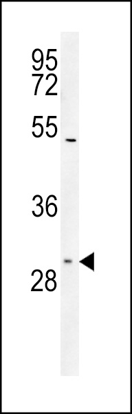 TXTP Antibody (Center) (Cat# 102-16513) western blot analysis in Jurkat cell line lysates (35ug/lane).This demonstrates the TXTP antibody detected the TXTP protein (arrow).