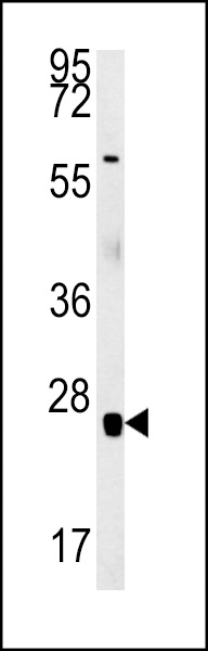 RBM24 Antibody (N-term) (Cat# 102-16537) western blot analysis in mouse heart tissue lysates (15ug/lane).This demonstrates the RBM24 antibody detected RBM24 protein (arrow).