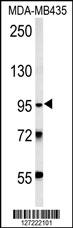 TRHDE Antibody (C-term) (Cat# 102-16546) western blot analysis in MDA-MB435 cell line lysates (15ug/lane).This demonstrates the TRHDE antibody detected the TRHDE protein (arrow).