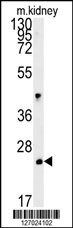 LHPL3 Antibody (C-term) (Cat# 102-16563) western blot analysis in mouse kidney tissue lysates (15ug/lane).This demonstrates the LHPL3 antibody detected the LHPL3 protein (arrow).