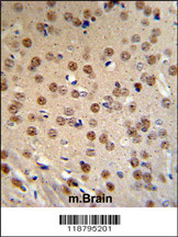 WTX Antibody (Center) (Cat# 102-16820) IHC analysis in formalin fixed and paraffin embedded mouse brain tissue followed by peroxidase conjugation of the secondary antibody and DAB staining. This data demonstrates the use of the WTX Antibody (Center) for immunohistochemistry. Clinical relevance has not been evaluated.