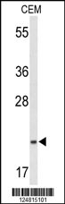 Western blot analysis of TIFA Antibody (N-term) (Cat# 102-18321) in CEM cell line lysates (35ug/lane). TIFA (arrow) was detected using the purified Pab.