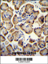 RADIL antibody (C-term) (Cat# 102-10603) immunohistochemistry analysis in formalin fixed and paraffin embedded human pancreas tissue followed by peroxidase conjugation of the secondary antibody and DAB staining. This data demonstrates the use of the RADIL antibody (C-term) for immunohistochemistry. Clinical relevance has not been evaluated.