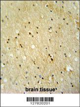 VWA3B antibody (C-term) (Cat# 102-10620) immunohistochemistry analysis in formalin fixed and paraffin embedded human brain tissue followed by peroxidase conjugation of the secondary antibody and DAB staining. This data demonstrates the use of the VWA3B antibody (C-term) for immunohistochemistry. Clinical relevance has not been evaluated.