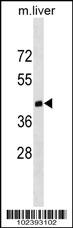 Dnmt3l Antibody (C403) (Cat# 102-10722) western blot analysis in mouse liver tissue lysates (35ug/lane).This demonstrates the Dnmt3l antibody detected the Dnmt3l protein (arrow).