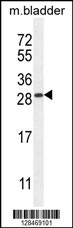 TIFAB Antibody (Center) (Cat# 102-10843) western blot analysis in mouse bladder tissue lysates (35ug/lane).This demonstrates the TIFAB antibody detected the TIFAB protein (arrow).