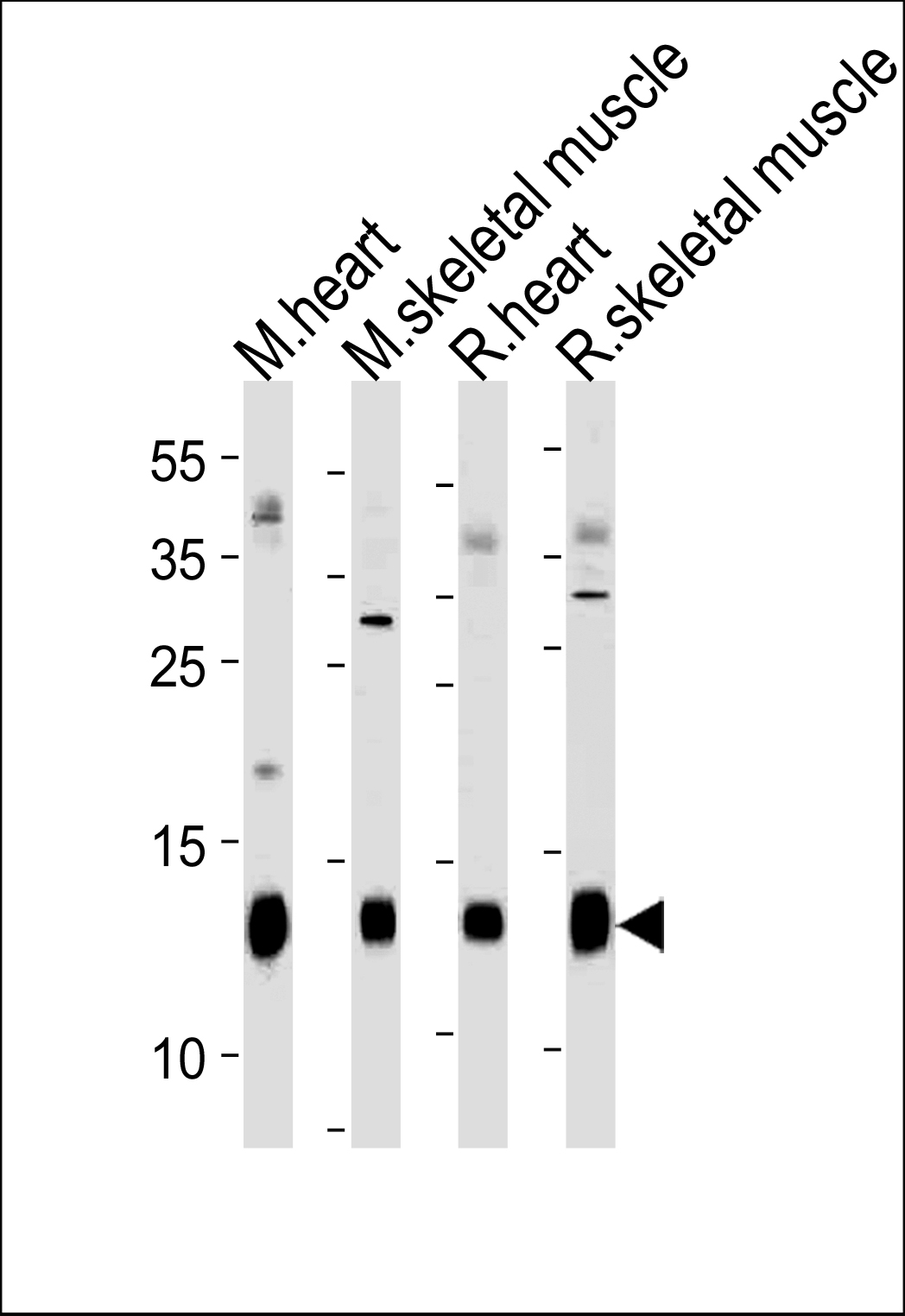 PLM Antibody (E1) (Cat# 102-11025) western blot analysis in mouse heart,skeletal muscle and rat heart,skeletal muscle tissue lysates (35ug/lane).This demonstrates the PLM antibody detected the PLM protein (arrow).