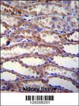 SHISA3 Antibody (C-term) (Cat# 102-11262)immunohistochemistry analysis in formalin fixed and paraffin embedded human kidney tissue followed by peroxidase conjugation of the secondary antibody and DAB staining.This data demonstrates the use of SHISA3 Antibody (C-term) for immunohistochemistry. Clinical relevance has not been evaluated.