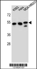 TUBB6 Antibody (Center) (Cat# 102-11316) western blot analysis in K562,Hela,MDA-MB231 cell line lysates (35ug/lane).This demonstrates the TUBB6 antibody detected the TUBB6 protein (arrow).