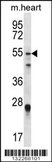 FOXO6 Antibody (Center) (Cat# 102-11517) western blot analysis in mouse heart tissue lysates (35ug/lane).This demonstrates the FOXO6 antibody detected the FOXO6 protein (arrow).