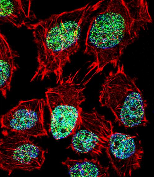 Fluorescent confocal image of U251 cell stained with FOXO6 Antibody (Center)(Cat# 102-11517).U251 cells were fixed with 4% PFA (20 min), permeabilized with Triton X-100 (0.1%, 10 min), then incubated with FOXO6 primary antibody (1:25, 1 h at 37°). For secondary antibody, Alexa Fluor® 488 conjugated donkey anti-rabbit antibody (green) was used (1:400, 50 min at 37°).Cytoplasmic actin was counterstained with Alexa Fluor® 555 (red) conjugated Phalloidin (7units/ml, 1 h at 37°). Nuclei were counterstained with DAPI (blue) (10 µg/ml, 10 min). FOXO6 immunoreactivity is localized to Cytoplasm and Nucleus significantly.