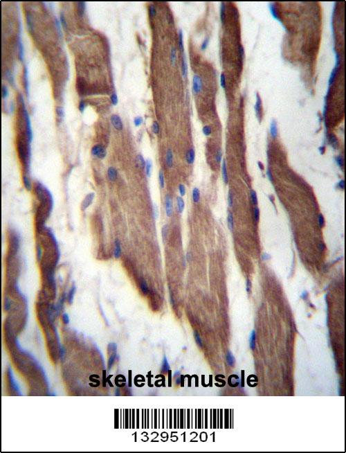 TGFBRAP1 Antibody (C-term) (Cat# 102-11995)immunohistochemistry analysis in formalin fixed and paraffin embedded human skeletal muscle followed by peroxidase conjugation of the secondary antibody and DAB staining.This data demonstrates the use of TGFBRAP1 Antibody (C-term) for immunohistochemistry. Clinical relevance has not been evaluated.