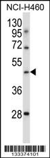 TLE6 Antibody (N-term ) (Cat# 102-12021) western blot analysis in NCI-H460 cell line lysates (35ug/lane).This demonstrates the TLE6 antibody detected the TLE6 protein (arrow).