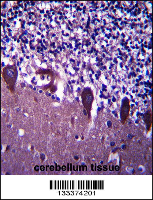 TLE6 Antibody (N-term) (Cat# 102-12021)immunohistochemistry analysis in formalin fixed and paraffin embedded human cerebellum tissue followed by peroxidase conjugation of the secondary antibody and DAB staining.This data demonstrates the use of TLE6 Antibody (N-term) for immunohistochemistry. Clinical relevance has not been evaluated.