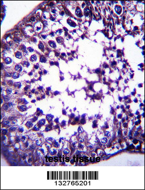 TSPYL5 Antibody (C-term) (Cat# 102-12065)immunohistochemistry analysis in formalin fixed and paraffin embedded human testis tissue followed by peroxidase conjugation of the secondary antibody and DAB staining.This data demonstrates the use of TSPYL5 Antibody (C-term) for immunohistochemistry. Clinical relevance has not been evaluated.