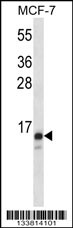 TIMM23 Antibody (C-term) (Cat# 102-12308) western blot analysis in MCF-7 cell line lysates (35ug/lane).This demonstrates the TIMM23 antibody detected the TIMM23 protein (arrow).